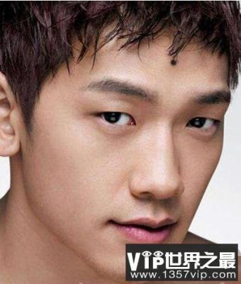 男人发际线有痣代表着什么 如何看男人发际线上的痣