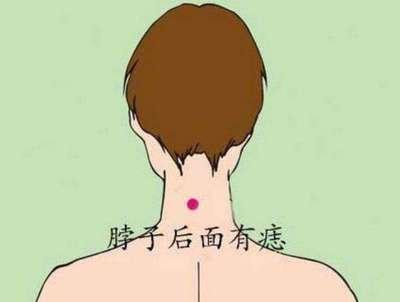 男人脖子后面有痣图解 男人后脖有痣代表着什么