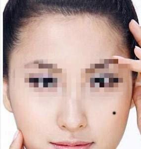 男人哪里长痣最有福气 男人痣长在什么地方福气好