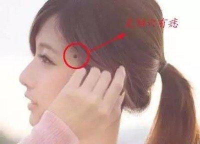 男人花心痣 男人什么地方长痣代表花心