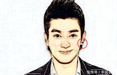 男人身上富贵痣千万不能点 男人这几个地方长痣好