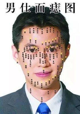 男生脸上长痣面相图 脸上有痣的男人命运如何