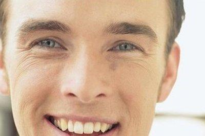 男人长鱼尾纹命运如何 有鱼尾纹的男人性格与命运分析