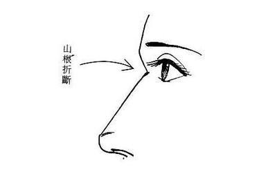 男人山根断裂的面相分析 山根断裂的男人命好吗