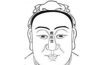 男人山根断裂的面相分析 男人山根断好吗