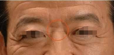 男人山根有横纹 山根有横纹的男人运势如何