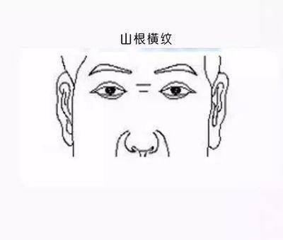 男人山根有横纹代表什么 山根有横纹的男人命好吗 男人山根有横纹代表什么 山根有横纹的男人命好吗