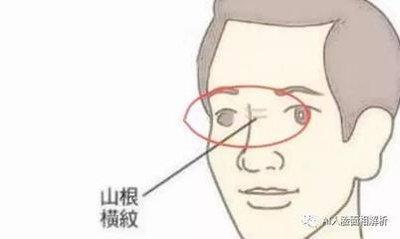 男人山根有横纹面相如何 男人山根出现横纹是什么意思