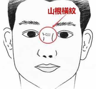 男人山根有横纹面相如何 男人山根出现横纹是什么意思