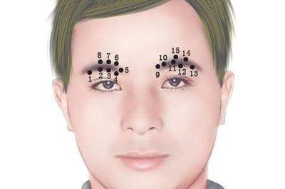 男人面部痣相图解分析大全 男人脸上有痣说明什么