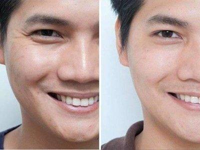 男人鱼尾纹多代表什么 分析鱼尾纹多的男人命运