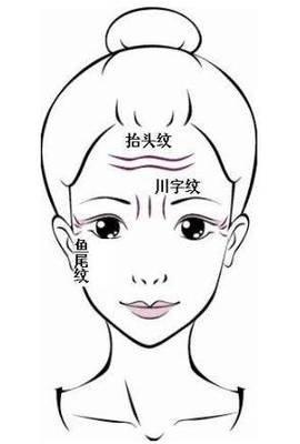 男人鱼尾纹多面相代表了什么 鱼尾纹多的男人命运好吗