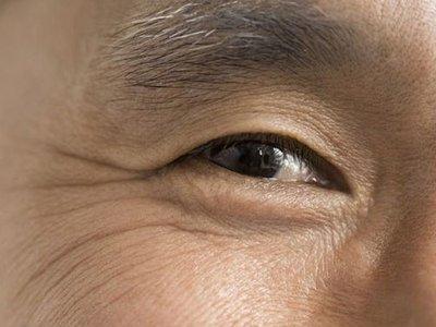 男人鱼尾纹多预示着什么 鱼尾纹多的男人命好吗
