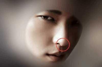 男人鼻子上长痣命运如何 男的鼻上长痣代表什么