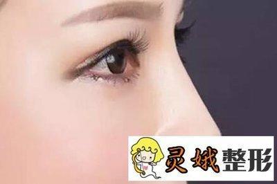 男人鼻子塌陷命运 塌鼻子的男人命好吗 男人鼻子塌陷命运 塌鼻子的男人命好吗