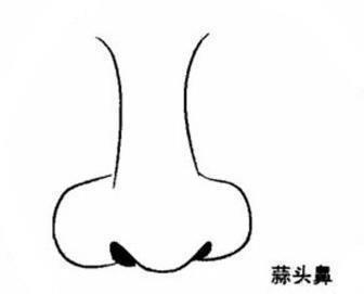 男人鼻子面相看蒜头鼻，蒜头鼻的男人面相如何