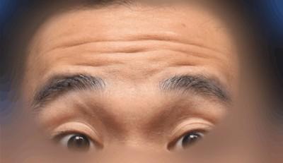 男人抬头纹的面相图解 男人长有抬头纹好不好