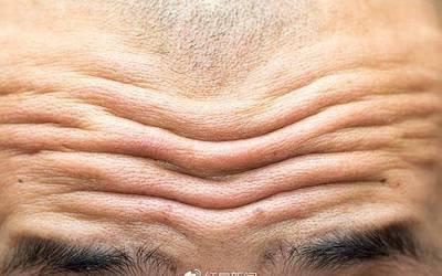 男人抬头纹的面相图解 男人长有抬头纹好吗