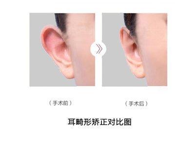 男人招风耳的婚姻好吗 招风耳的男人命运如何