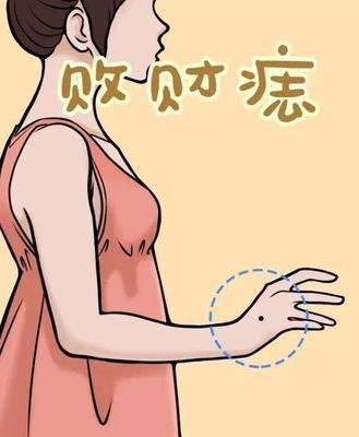痣相图解女人手背长痣代表什么 手背长痣的女人命好吗