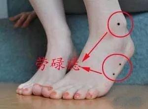 痣相学中关于不同部位的痣所代表的性格