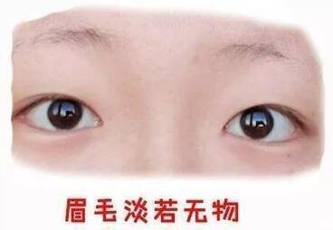 眉毛淡的人运势怎样 眉毛淡是什么意思