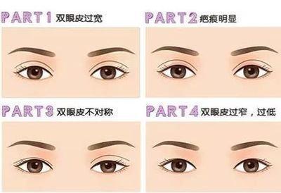 眼皮面相分析 带你了解更多眼皮面相知识 眼皮面相分析 带你了解更多眼皮面相知识