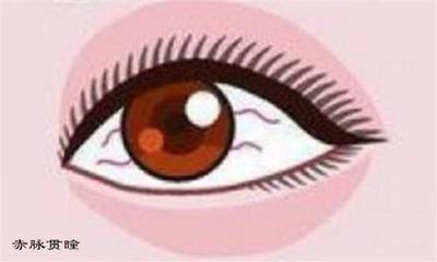 眼睛突出的人面相 人的眼睛突出说明了什么 眼睛突出的人面相 人的眼睛突出说明了什么