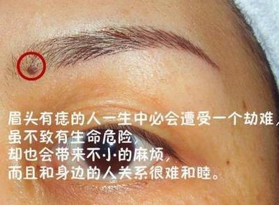 眉毛里有痣的女人运势很旺吗 女人眉毛长痣好不好