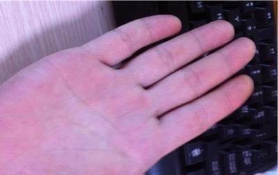 眉毛长痣的人运顺吗 眉毛有痣是什么意思