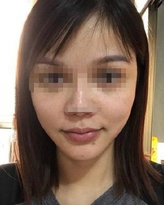 眼窝凹陷婚姻易不顺是真的吗 眼窝凹陷的人能不能幸福