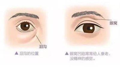 眼窝凹陷面相分析 眼窝凹陷的人是不是运气很差