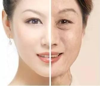 眼窝凹陷面相好吗 眼窝凹陷会有哪些影响