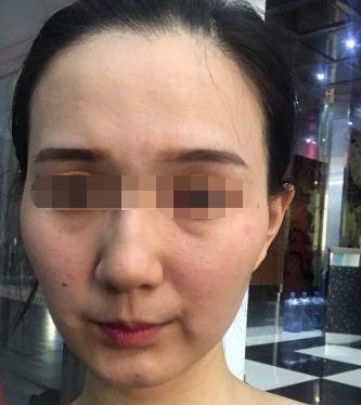 眼窝深的女人面相代表什么 女人眼窝深好不好