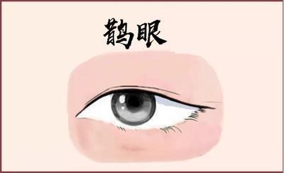 眼窝深陷面相 眼窝深陷的人命运如何