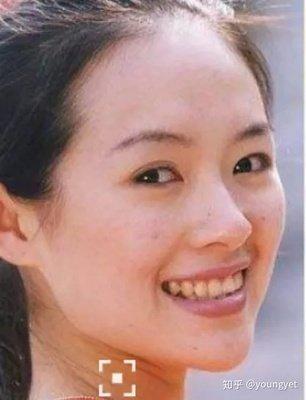 眼窝深陷面相 眼窝深陷的人命运如何