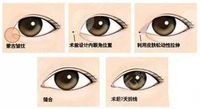 眼角上扬代表什么 眼角上扬的人命好吗