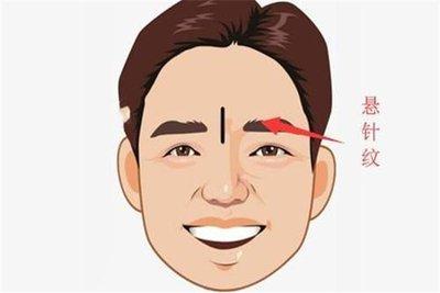 眉间悬针纹的面相分析 眉间有悬针纹的人命运如何