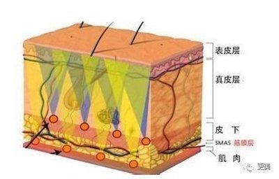 眉间有疤的女人命运 眉毛上有疤痕好不好
