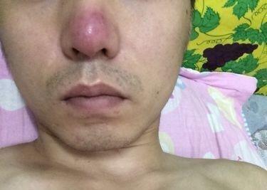 破财有征兆一看面相就知道了有这些特征 破财有征兆一看面相就知道了有这些特征