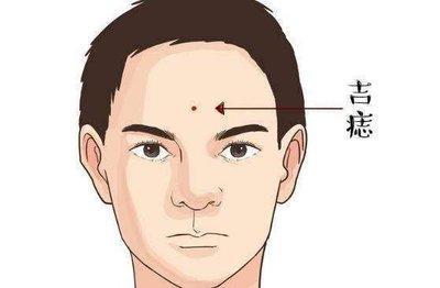 看看你有没有富贵痣 富贵痣在什么位置