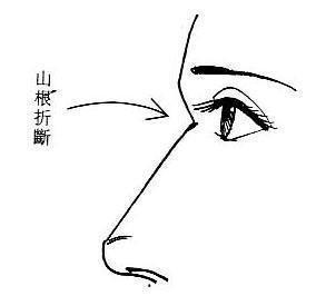 相学：山根断了的人命运怎么样 怎么改运