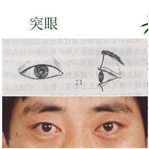 眉毛尾部下垂的人面相怎么样 眉尾下垂说明了什么