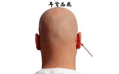 背后有痣(背后有痣的男人命运如何)