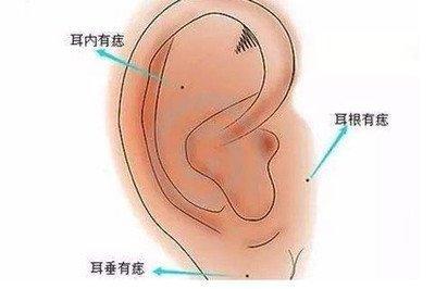 耳垂下方有痣代表什么 哪些地方长痣最好