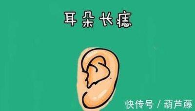耳朵上有痣好不好 耳朵长痣会有影响吗