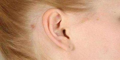 耳朵代表的命运 看耳朵面相了解命运好坏 耳朵代表的命运 看耳朵面相了解命运好坏