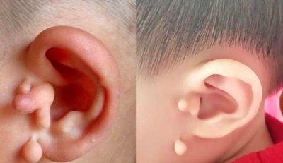 耳朵大的人就一定有福气吗 耳朵大说明了什么