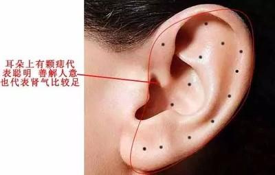 耳朵有痣代表着啥人耳朵上有痣代表什么