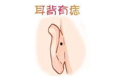 耳朵有痣命运好不好 耳朵长痣说明了什么